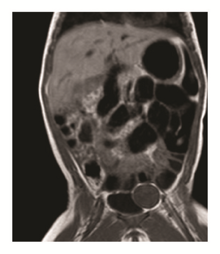 Details are in the caption following the image