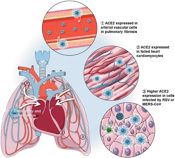 Single-cell RNA analysis on ACE2 expression provides insights into SARS-CoV-2 potential entry into the bloodstream and heart injury