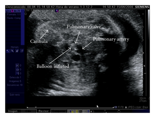 Details are in the caption following the image Details are in the caption following the image