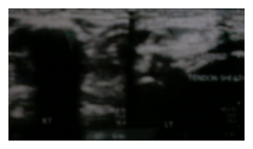 Details are in the caption following the image