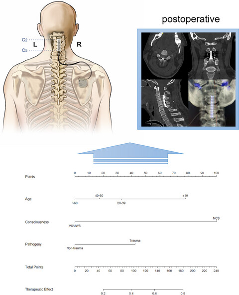 Long-term functional prognosis and related factors of spinal cord stimulation in patients with disorders of consciousness