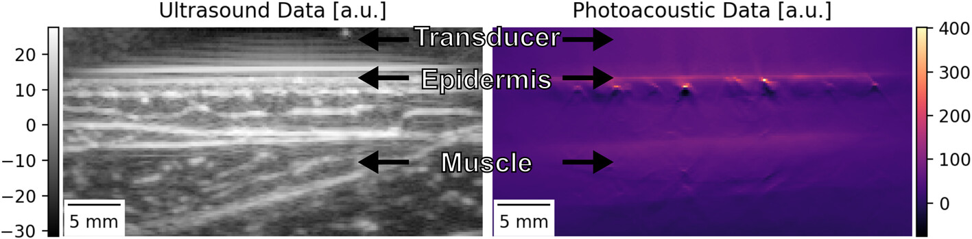 Teachability of multispectral optoacoustic tomography