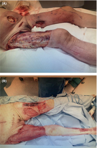 Details are in the caption following the image Details are in the caption following the image
