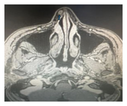 Details are in the caption following the image