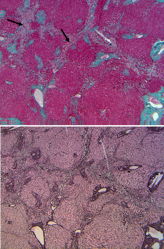 Details are in the caption following the image