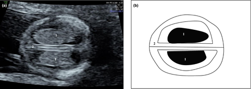 Details are in the caption following the image