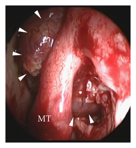 Details are in the caption following the image Details are in the caption following the image