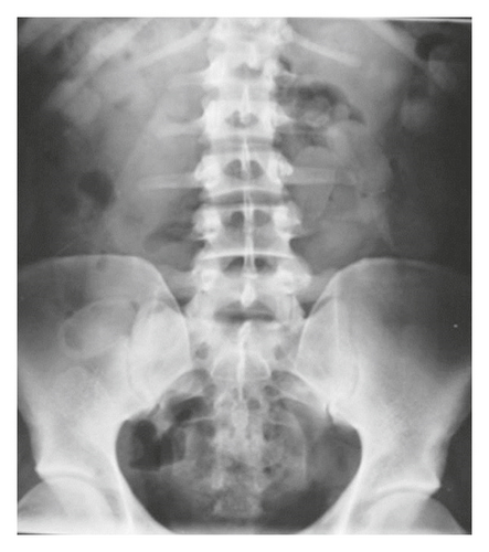 Details are in the caption following the image
