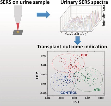 Surface-enhanced Raman scattering analysis of urine from deceased donors as a prognostic tool for kidney transplant outcome