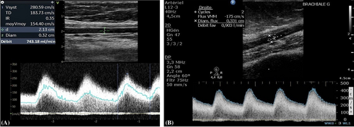 Details are in the caption following the image Details are in the caption following the image