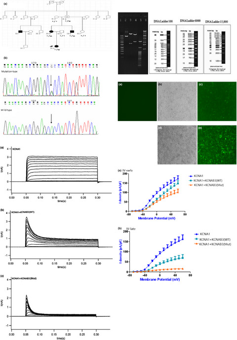 H258R mutation in KCNAB3 gene in a family with genetic epilepsy and febrile seizures plus