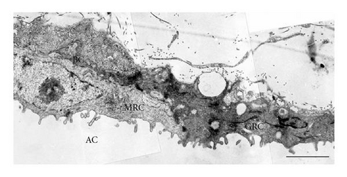 Details are in the caption following the image