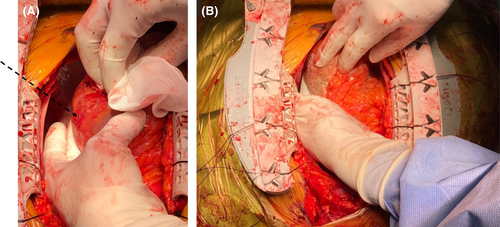 Details are in the caption following the image Details are in the caption following the image