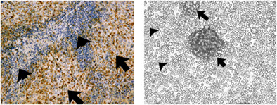 Experimental model of micronodular thymic neoplasm with lymphoid stroma