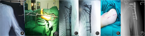 Details are in the caption following the image Details are in the caption following the image