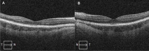 Details are in the caption following the image