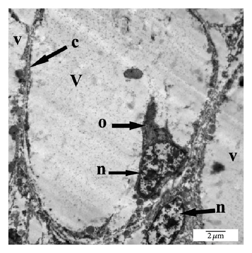 Details are in the caption following the image