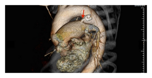 Details are in the caption following the image