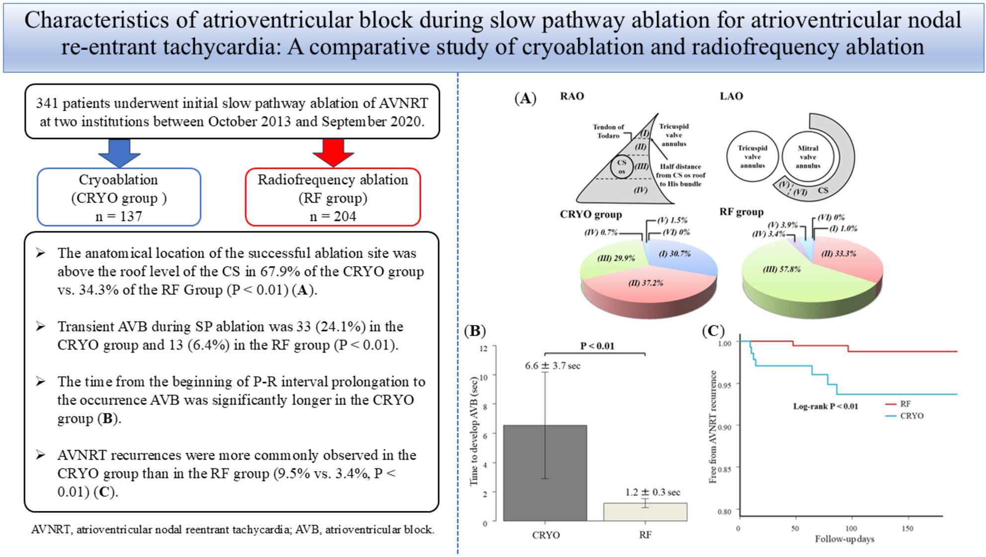 Characteristics of atrioventricular block during slow pathway ablation for atrioventricular nodal re-entrant tachycardia: A comparative study of cryoablation and radiofrequency ablation