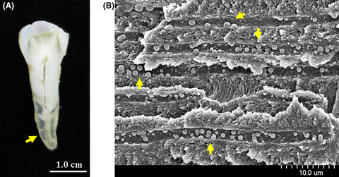 Transparent dentin region in the tooth root
