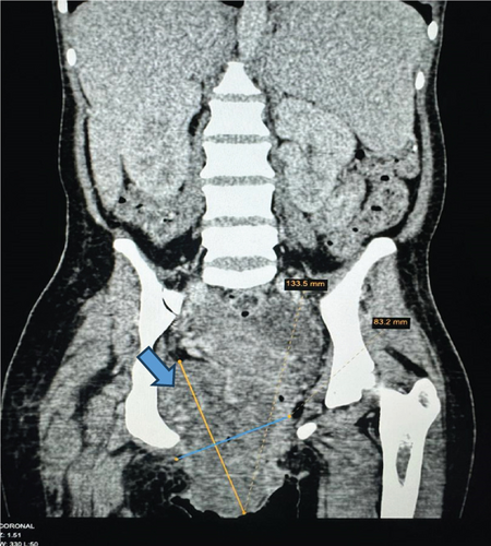 Details are in the caption following the image