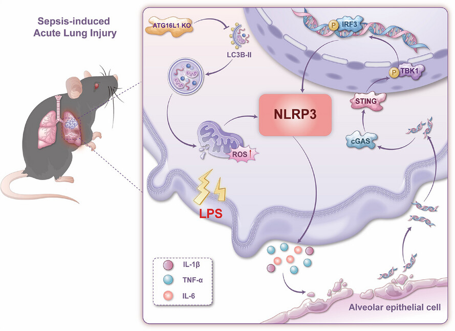 ATG16L1 restrains macrophage NLRP3 activation and alveolar epithelial cell injury during septic lung injury