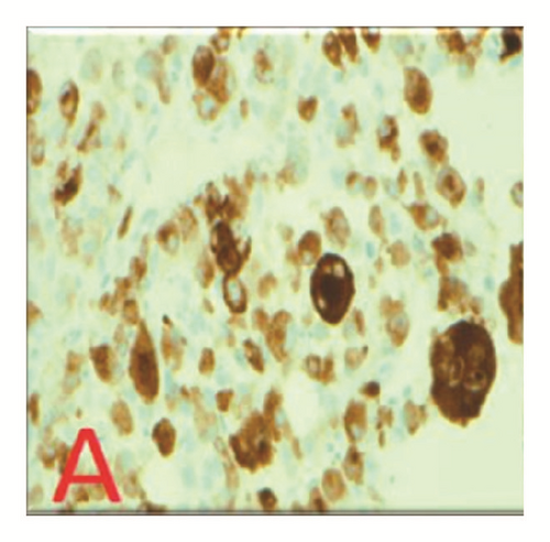 Details are in the caption following the image