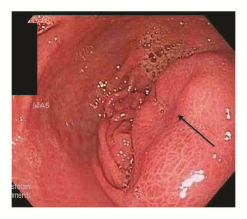 Details are in the caption following the image Details are in the caption following the image