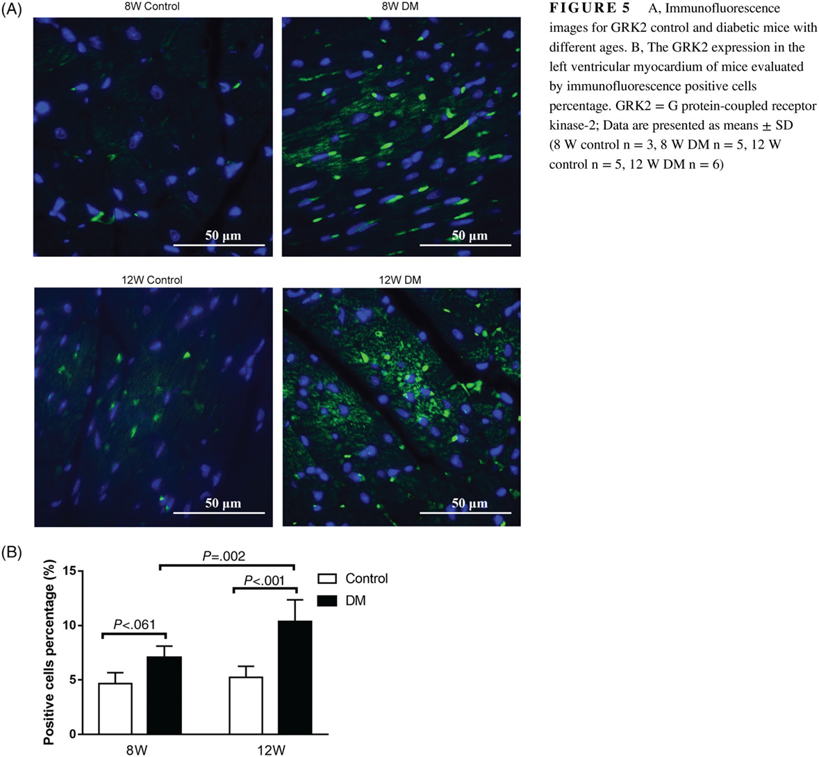 G protein-coupled receptor kinase-2: A potential biomarker for early diabetic cardiomyopathy G蛋白偶联受体激酶2:早期糖尿病心肌病的潜在生物标记物