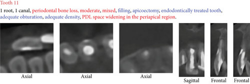 Details are in the caption following the image