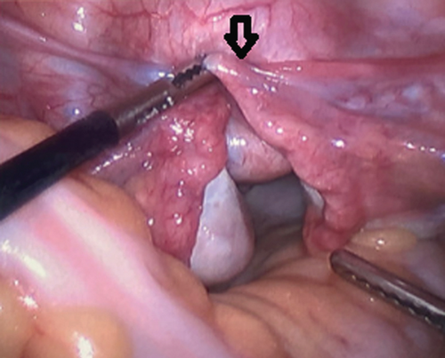 Details are in the caption following the image Details are in the caption following the image