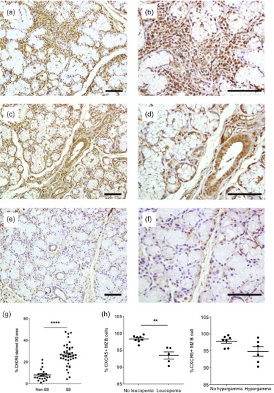 Diminished CXCR5 expression in peripheral blood of patients with Sjögren's syndrome may relate to both genotype and salivary gland homing