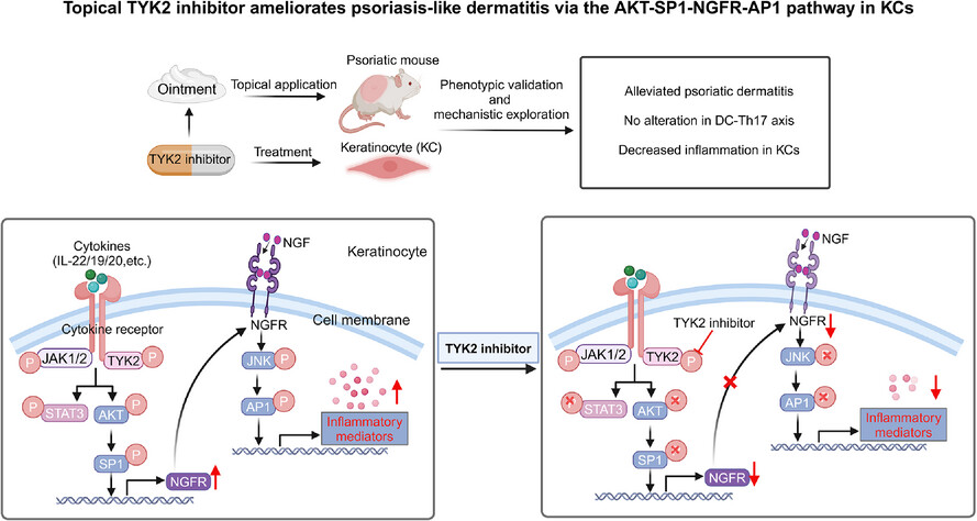 Topical TYK2 inhibitor ameliorates psoriasis-like dermatitis via the AKT-SP1-NGFR-AP1 pathway in keratinocytes