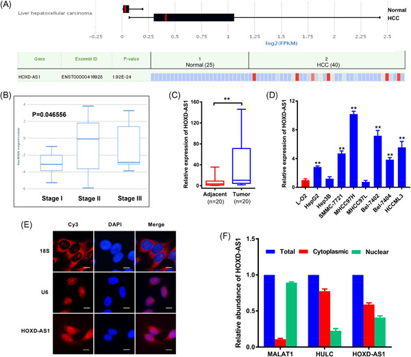 Silencing of long noncoding RNA HOXD-AS1 inhibits proliferation, cell cycle progression, migration and invasion of hepatocellular carcinoma cells through MEK/ERK pathway