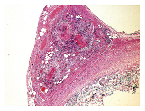 Details are in the caption following the image