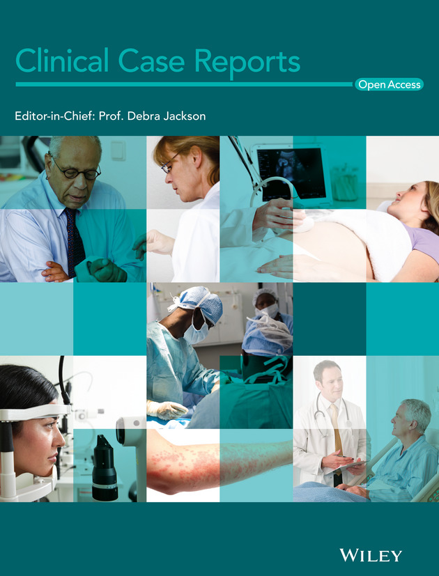 Upper limb erythema nodosum: the first presentation of Crohn's disease