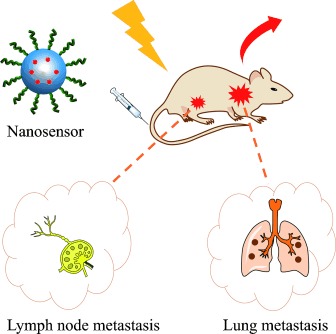 Tracking Cancer Metastasis In Vivo by Using an Iridium-Based Hypoxia-Activated Optical Oxygen Nanosensor