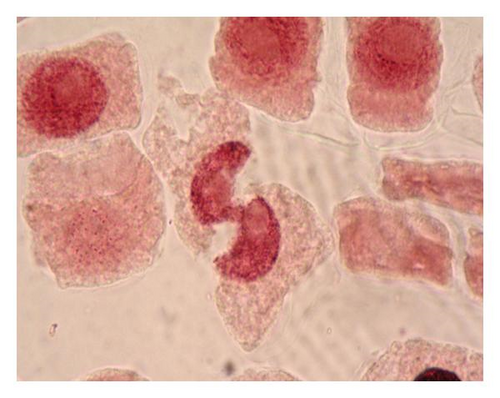 Details are in the caption following the image