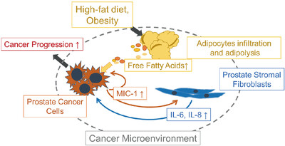 Macrophage inhibitory cytokine-1 induced by a high-fat diet promotes prostate cancer progression by stimulating tumor-promoting cytokine production from tumor stromal cells