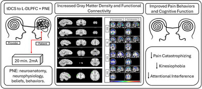 The Effect of Combining Transcranial Direct Current Stimulation and Pain Neuroscience Education in Patients With Chronic Low Back Pain and High Pain Catastrophizing: An Exploratory Clinical, Cognitive, and fMRI Study