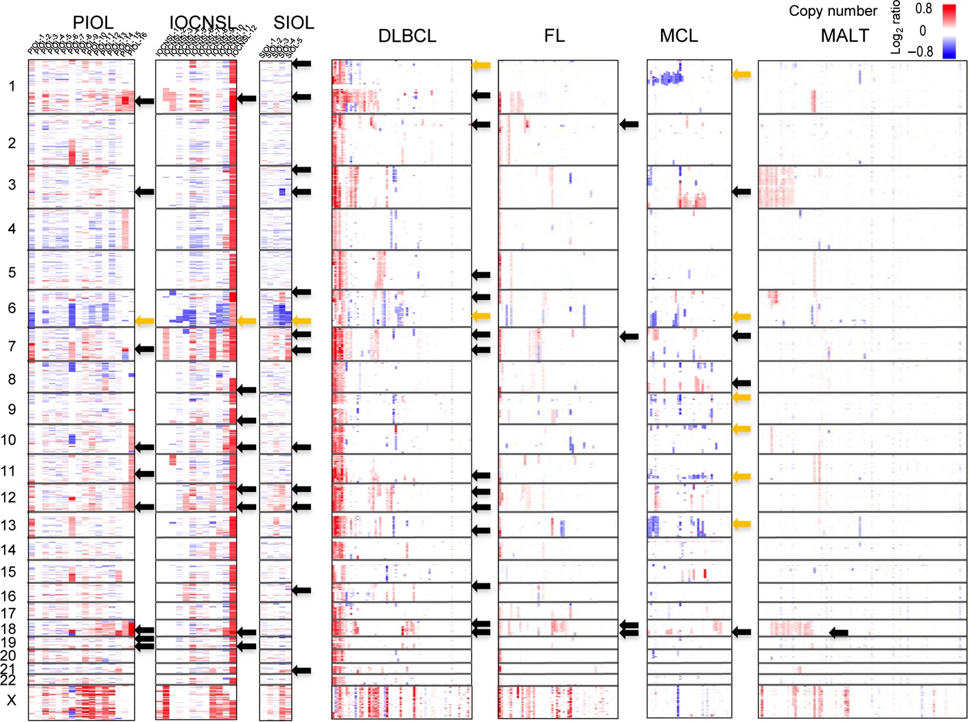 High-resolution genomic copy number profiling of primary intraocular lymphoma by single nucleotide polymorphism microarrays