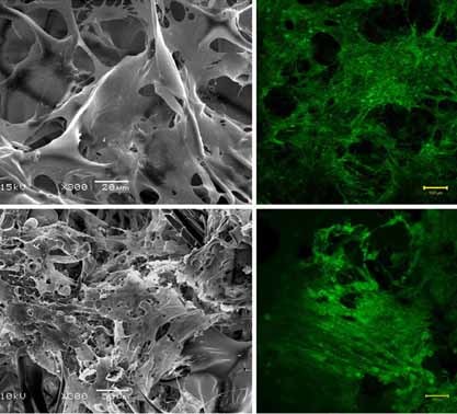 In Vitro Evaluation of Combined Sulfated Silk Fibroin Scaffolds for Vascular Cell Growth