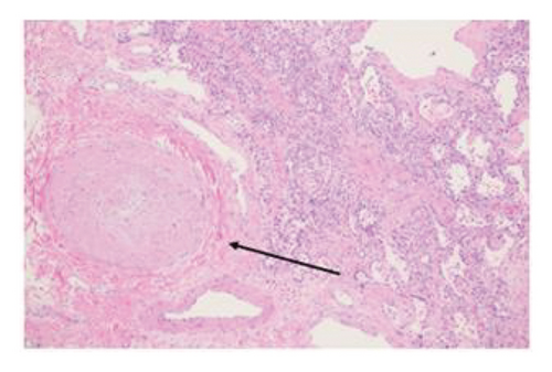 Details are in the caption following the image