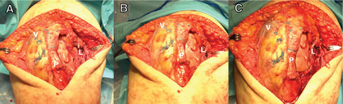 Details are in the caption following the image Details are in the caption following the image