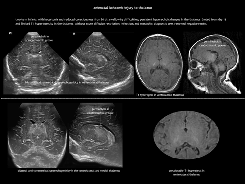 Details are in the caption following the image Details are in the caption following the image