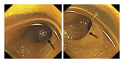 Details are in the caption following the image Details are in the caption following the image