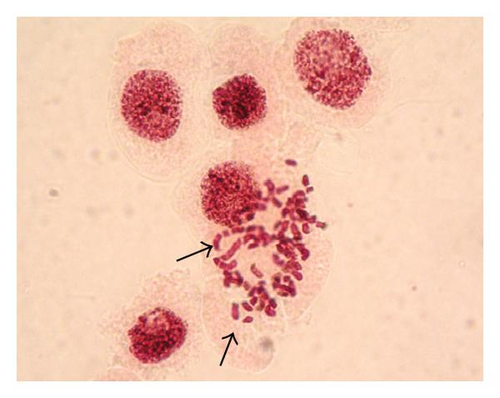 Details are in the caption following the image