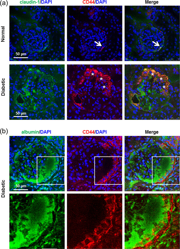 Albumin induces CD44 expression in glomerular parietal epithelial cells by activating extracellular signal-regulated kinase 1/2 pathway