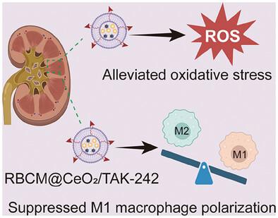 ROS Responsive Cerium Oxide Biomimetic Nanoparticles Alleviates Calcium Oxalate Crystals Induced Kidney Injury via Suppressing Oxidative Stress and M1 Macrophage Polarization