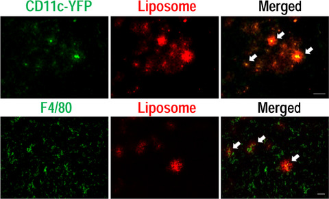 Optimal therapeutic strategy using antigen-containing liposomes selectively delivered to antigen-presenting cells